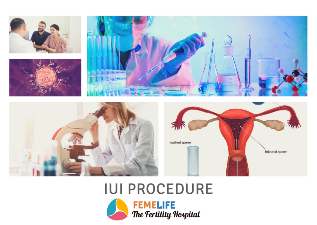 IUI Procedure