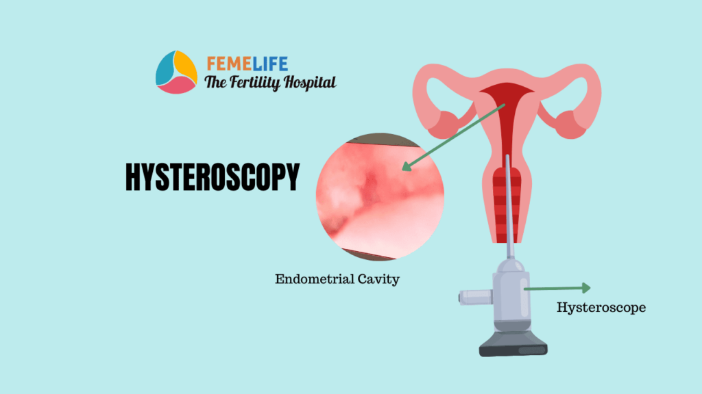 Hysteroscopy