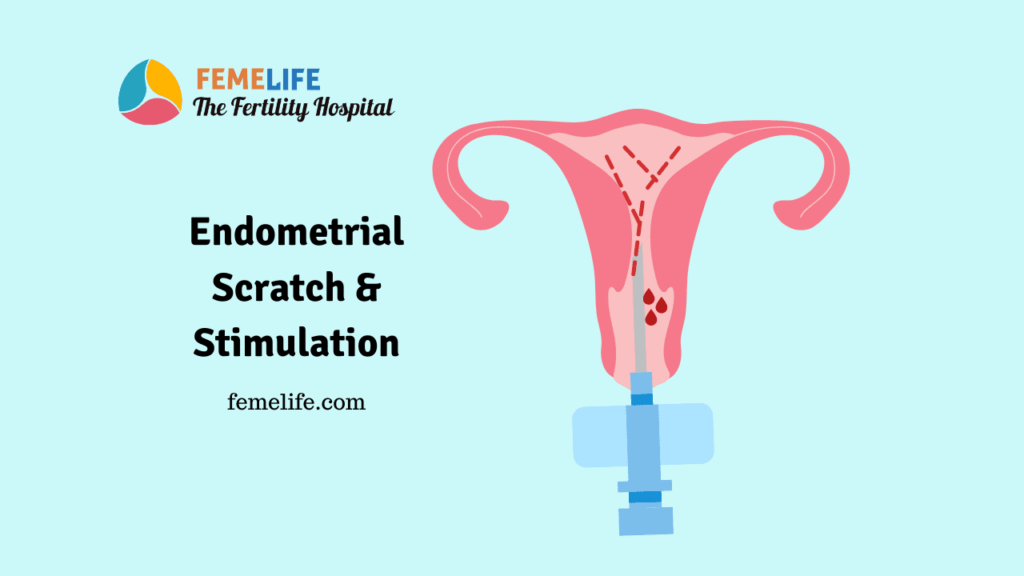 Endometrial scratch