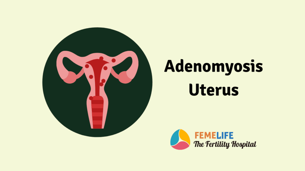 Adenomyosis Uterus