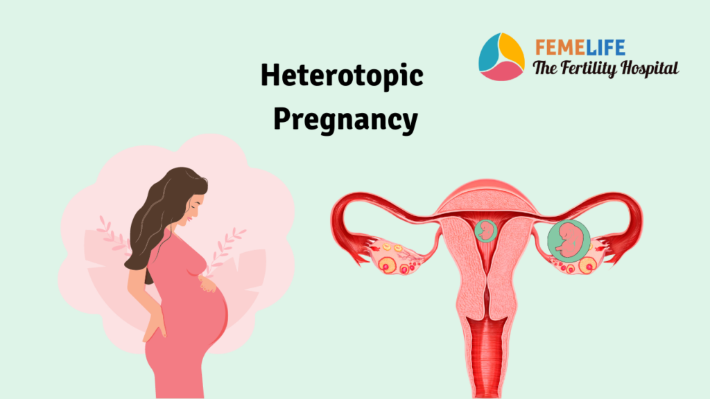 Heterotopic Pregnancy