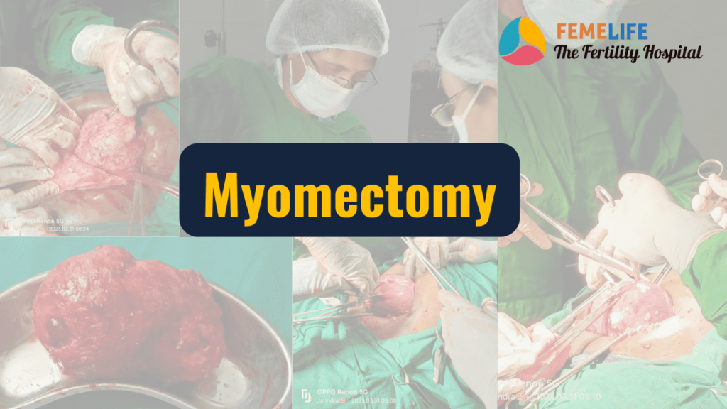 Myomectomy